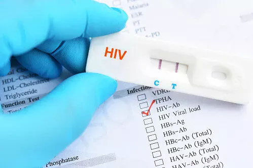 Transmission volontaire du VIH : ce que prévoit la loi